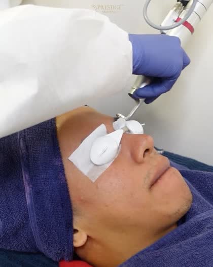 Azzfar Hassan at Prestige Medispa